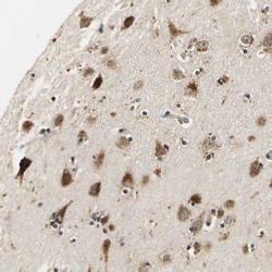 smu1 Antibody, Novus Biologicals 25 &mu;L | Buy Online | Novus Biologicals | Fisher Scientific