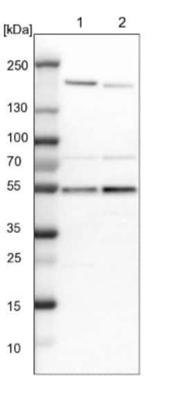 smu1 Antibody, Novus Biologicals 25 &mu;L | Buy Online | Novus Biologicals | Fisher Scientific