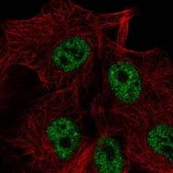 solute carrier family 22, member 18 antisense Antibody, Novus Biologicals