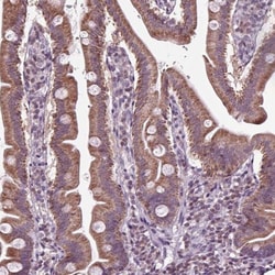 solute carrier family 22, member 18 antisense Antibody, Novus Biologicals