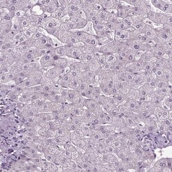 solute carrier family 22, member 18 antisense Antibody, Novus Biologicals
