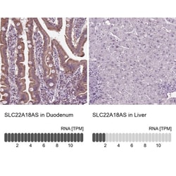 solute carrier family 22, member 18 antisense Antibody, Novus Biologicals