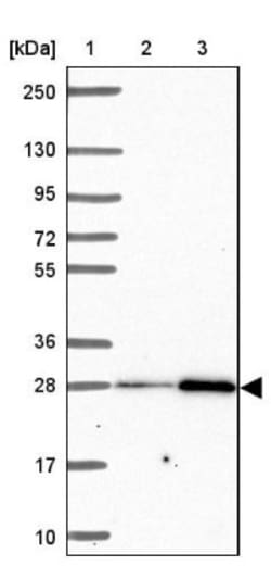 solute carrier family 22, member 18 antisense Antibody, Novus Biologicals