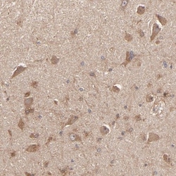 stonin-2 Antibody, Novus Biologicals 0.1mL; Unlabeled:Antibodies, Polyclonal