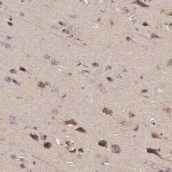 stonin-2 Antibody, Novus Biologicals 0.1mL; Unlabeled:Antibodies, Polyclonal