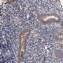 stonin-2 Antibody, Novus Biologicals 0.1mL; Unlabeled:Antibodies, Polyclonal