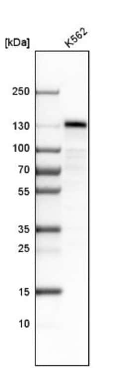 stonin-2 Antibody, Novus Biologicals 0.1mL; Unlabeled:Antibodies, Polyclonal