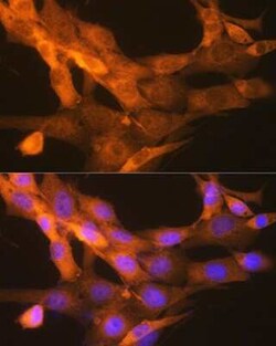 t-Plasminogen Activator/tPA Rabbit anti-Human, Mouse, Rat, Clone: 10W4L1, Novus Biologicals 100 &mu;g | Buy Online | Bio-Techne | Fisher Scientific