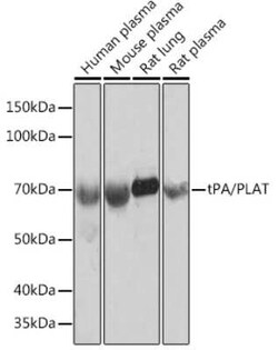 t-Plasminogen Activator/tPA Rabbit anti-Human, Mouse, Rat, Clone: 10W4L1, Novus Biologicals 100 &mu;g | Buy Online | Bio-Techne | Fisher Scientific