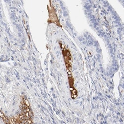 t-Plasminogen Activator/tPA Antibody, Novus Biologicals:Antibodies:Primary