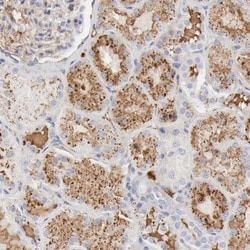 t-Plasminogen Activator/tPA Antibody, Novus Biologicals:Antibodies:Primary
