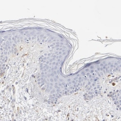 t-Plasminogen Activator/tPA Antibody, Novus Biologicals:Antibodies:Primary