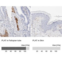 t-Plasminogen Activator/tPA Antibody, Novus Biologicals:Antibodies:Primary