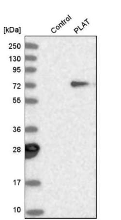 t-Plasminogen Activator/tPA Antibody, Novus Biologicals:Antibodies:Primary