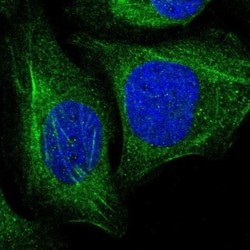 transgelin 2 Antibody, Novus Biologicals 0.1mL; Unlabeled:Antibodies, Polyclonal