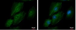 transgelin 2 Antibody, Novus Biologicals 0.1mL; Unlabeled:Antibodies, Polyclonal