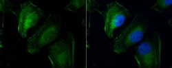 transgelin 2 Antibody, Novus Biologicals 0.1mL; Unlabeled:Antibodies, Polyclonal