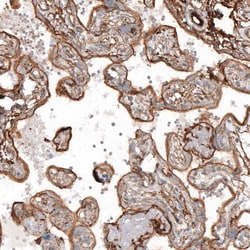 transgelin 2 Antibody, Novus Biologicals 0.1mL; Unlabeled:Antibodies, Polyclonal