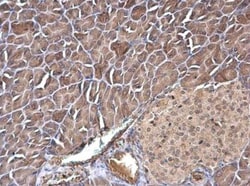 transgelin 2 Antibody, Novus Biologicals 0.1mL; Unlabeled:Antibodies, Polyclonal