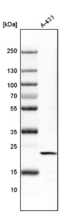 transgelin 2 Antibody, Novus Biologicals 0.1mL; Unlabeled:Antibodies, Polyclonal