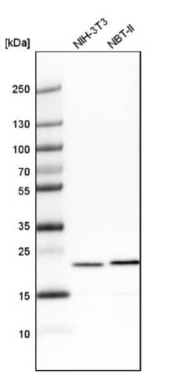 transgelin 2 Antibody, Novus Biologicals 0.1mL; Unlabeled:Antibodies, Polyclonal
