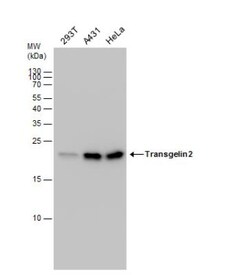 transgelin 2 Antibody, Novus Biologicals 0.1mL; Unlabeled:Antibodies, Polyclonal