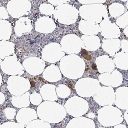 uPAR Antibody, Novus Biologicals:Antibodies:Primary Antibodies