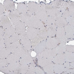 uPAR Antibody, Novus Biologicals:Antibodies:Primary Antibodies