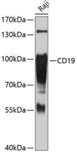 CD19 Antibody, ProSci 0.1 mL | Buy Online | ProSci LLC | Fisher Scientific