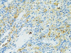 CD19 Antibody, ProSci 0.1 mL | Buy Online | ProSci LLC | Fisher Scientific