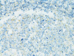 CD19 Antibody, ProSci 0.1 mL | Buy Online | ProSci LLC | Fisher Scientific