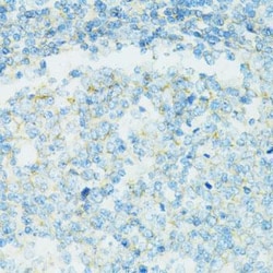 CD19 Antibody, ProSci 0.1 mL | Buy Online | ProSci LLC | Fisher Scientific