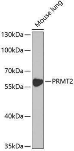 PRMT2 Antibody, ProSci 0.1 mL | Buy Online | ProSci LLC | Fisher Scientific