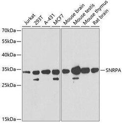 SNRPA Antibody, ProSci 0.1 mL | Buy Online | ProSci LLC | Fisher Scientific