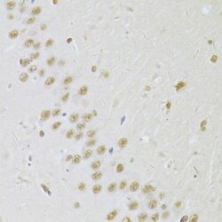 SNRPA Antibody, ProSci 0.1 mL | Buy Online | ProSci LLC | Fisher Scientific