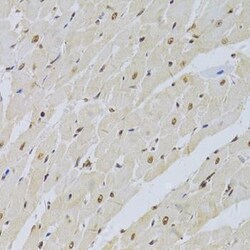 SNRPA Antibody, ProSci 0.1 mL | Buy Online | ProSci LLC | Fisher Scientific