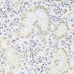 SNRPA Antibody, ProSci 0.1 mL | Buy Online | ProSci LLC | Fisher Scientific