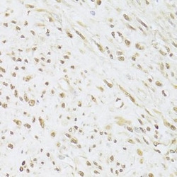 SNRPA Antibody, ProSci 0.1 mL | Buy Online | ProSci LLC | Fisher Scientific