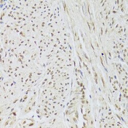 SNRPA Antibody, ProSci 0.1 mL | Buy Online | ProSci LLC | Fisher Scientific