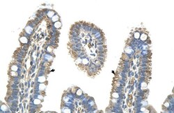 PANX1 Antibody, ProSci 0.1 mL | Buy Online | ProSci LLC | Fisher Scientific