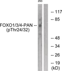 FOXO1/3/4-pan (phospho Thr24/32) Antibody, ProSci 0.1 mg | Buy Online | ProSci LLC | Fisher Scientific