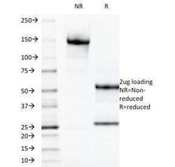 Galectin 13 Antibody [PP13/1165], ProSci 0.1 mg | Buy Online | ProSci LLC | Fisher Scientific