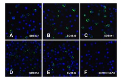 LAG3 Detection Set, ProSci 1 Set | Buy Online | ProSci LLC | Fisher Scientific