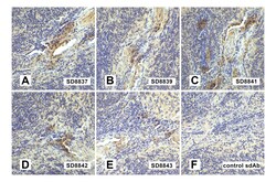 LAG3 Detection Set, ProSci 1 Set | Buy Online | ProSci LLC | Fisher Scientific