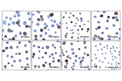 PDL1 Detection Set (Risk Free), ProSci 1 Set | Buy Online | ProSci LLC | Fisher Scientific