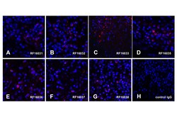 PDL1 Detection Set (Risk Free), ProSci 1 Set | Buy Online | ProSci LLC | Fisher Scientific