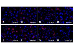 PDL1 Detection Set (Risk Free), ProSci 1 Set | Buy Online | ProSci LLC | Fisher Scientific