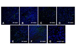 PD1 Detection Set (Risk Free), ProSci 1 Set | Buy Online | ProSci LLC | Fisher Scientific