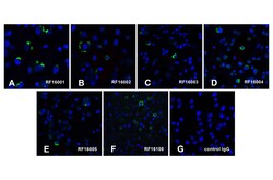 PD1 Detection Set (Risk Free), ProSci 1 Set | Buy Online | ProSci LLC | Fisher Scientific