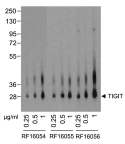 TIGIT Detection Set (Risk Free), ProSci 1 Set | Buy Online | ProSci LLC | Fisher Scientific